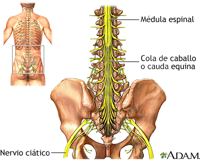 cola de caballo simulacrum