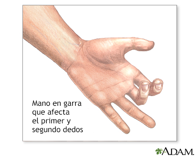 dedos de la mano lookalike